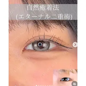 ルラ美容クリニック 札幌大通り院 能登 貴弘医師の症例