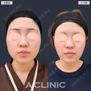 A CLINIC（エークリニック） 新宿院 瀬戸　翔太医師の症例