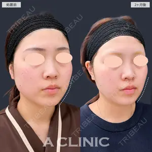 A CLINIC（エークリニック） 新宿院 瀬戸　翔太医師の症例