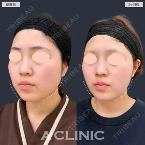 A CLINIC（エークリニック） 新宿院 瀬戸　翔太医師の症例