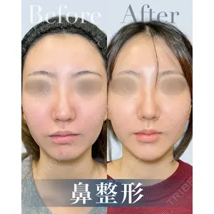 eクリニック 横浜みなとみらい院 坂本 優衣医師の症例