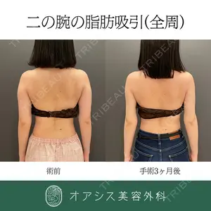 オアシス美容外科 遠藤 剛史医師の症例