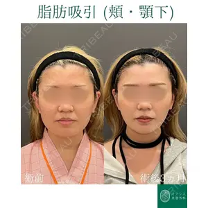 オアシス美容外科 遠藤 剛史医師の症例