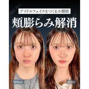 神戸美容外科 ネビュラクリニック 岩﨑 雅医師の症例