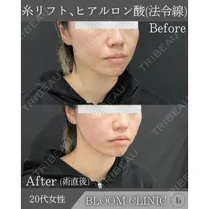 ブルームクリニック（BLOOM CLINIC）の症例