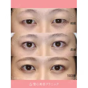 聖心美容クリニック 大阪院 大井 弘一医師の症例