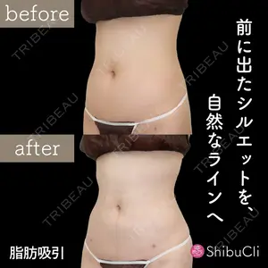 渋谷美容外科クリニック 渋谷院の症例
