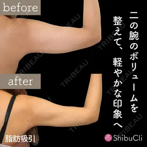 渋谷美容外科クリニック 渋谷院の症例