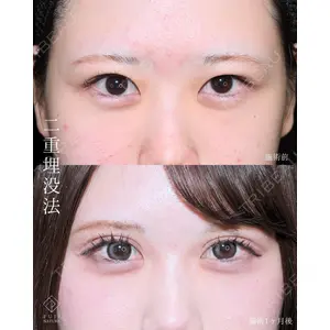 藤・ナチュレ美容クリニック 銀座院 小川 杏平医師の症例