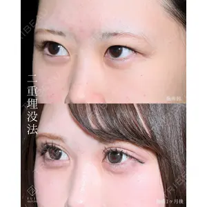 藤・ナチュレ美容クリニック 銀座院 小川 杏平医師の症例