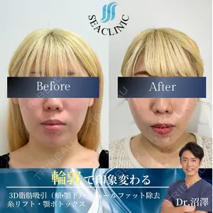 SEA CLINIC（シークリニック） 沼澤 茂医師の症例
