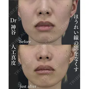EMMO FACE CLINIC 大阪梅田院 神谷 一成医師の症例