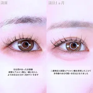 アリエル美容クリニック 水戸院 天白 典秀医師の症例
