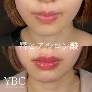 YBC横浜美容外科 池袋院 磯村 亮輔医師の症例