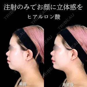 アリエル美容クリニック 大宮院 宮下宝樹医師の症例