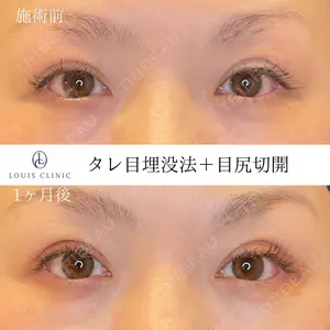 LOUIS CLINIC 二子玉川院【ルイクリニック】 小松 塁医師の症例
