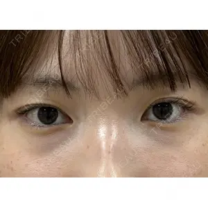 Ledian Clinic六本木 奥村 瞬医師の症例