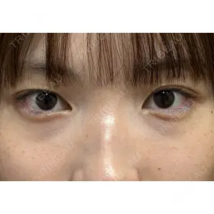 Ledian Clinic六本木 奥村 瞬医師の症例
