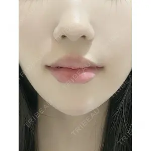 Ledian Clinic六本木 奥村 瞬医師の症例