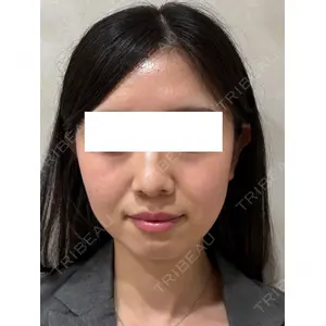Ledian Clinic六本木 奥村 瞬医師の症例