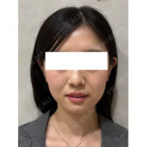 Ledian Clinic六本木 奥村 瞬医師の症例