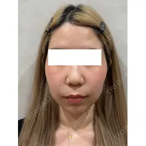 Ledian Clinic六本木 奥村 瞬医師の症例