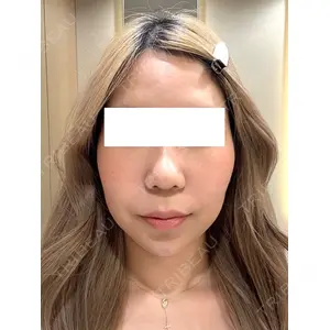 Ledian Clinic六本木 奥村 瞬医師の症例