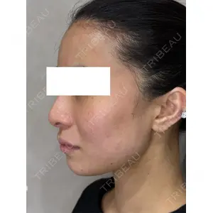 Ledian Clinic六本木 ヨシカワ　サヤカ医師の症例