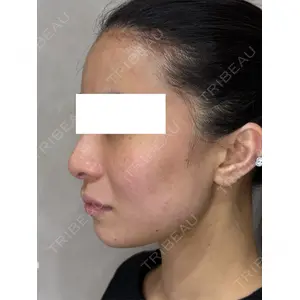 Ledian Clinic六本木 ヨシカワ　サヤカ医師の症例