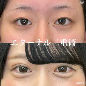 ルラ美容クリニック 名古屋栄院 / ルラスキンクリニック 名古屋栄院 関戸 優医師の症例