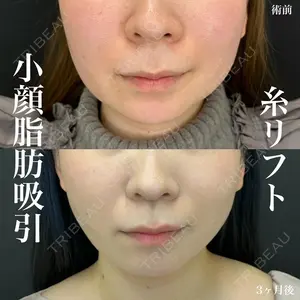 ルラ美容クリニック 名古屋栄院 / ルラスキンクリニック 名古屋栄院 関戸 優医師の症例