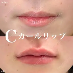 ルラ美容クリニック 名古屋栄院 / ルラスキンクリニック 名古屋栄院 関戸 優医師の症例