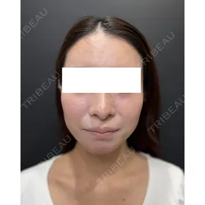 Ledian Clinic六本木 奥村 瞬医師の症例