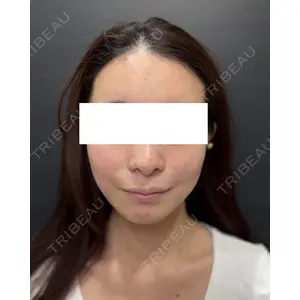 Ledian Clinic六本木 奥村 瞬医師の症例