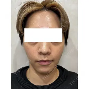 Ledian Clinic六本木の症例