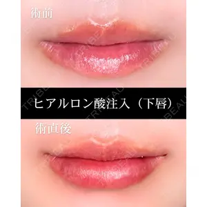 HAAB CLINIC 福岡院 米谷 拓朗医師の症例