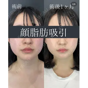 ルラ美容クリニック 名古屋本院 鶴田 佳雅医師の症例