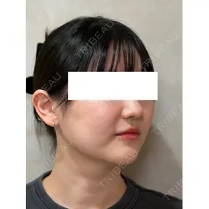 Ledian Clinic六本木 奥村 瞬医師の症例