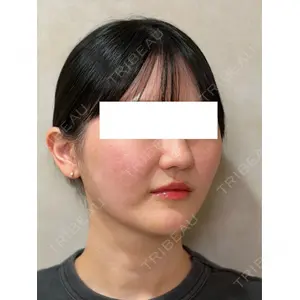 Ledian Clinic六本木 奥村 瞬医師の症例