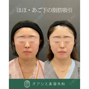 オアシス美容外科 遠藤 剛史医師の症例