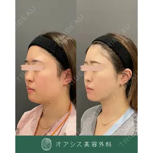 オアシス美容外科 遠藤 剛史医師の症例