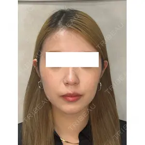 Ledian Clinic六本木 奥村 瞬医師の症例