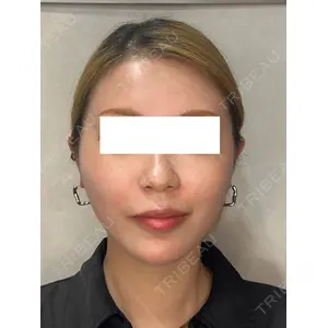 Ledian Clinic六本木 奥村 瞬医師の症例