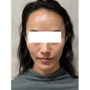 Ledian Clinic六本木 奥村 瞬医師の症例