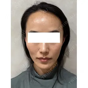 Ledian Clinic六本木 奥村 瞬医師の症例