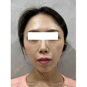 Ledian Clinic六本木 奥村 瞬医師の症例