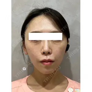 Ledian Clinic六本木 奥村 瞬医師の症例