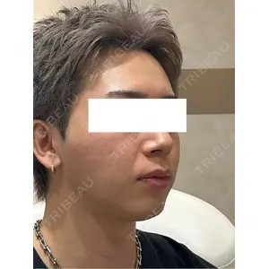 Ledian Clinic六本木 奥村 瞬医師の症例