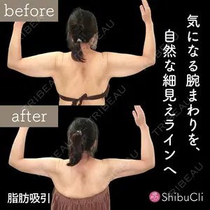 渋谷美容外科クリニック 渋谷院の症例