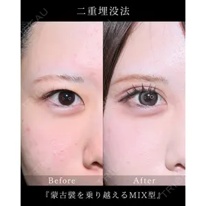 藤・ナチュレ美容クリニック 銀座院 小川 杏平医師の症例